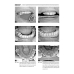 Диагностика функциональных нарушений зубочелюстного аппарата