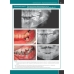 Хирургическая стоматология. Клинические протоколы