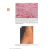 Интерпретация биопсий кожи. Первичные нелимфоидные опухоли кожи