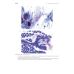 Йокогамская система интерпретации результатов тонкоигольной аспирационной биопсии молочной железы