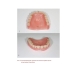 Новая технология реставрации съемных пластиночных зубных протезов после поломки: учебное пособие