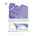 Прижизненная патолого-анатомическая диагностика болезней органов пищеварительной системы (класс XI МКБ-10)