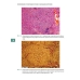Стимуляция регенерации печени у больных циррозом. 2-е изд.