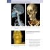 Судебно-медицинская радиология. От идентификации личности до посмертной визуализации