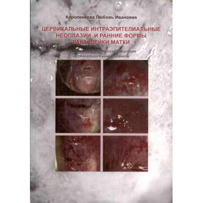 Цервикальные интраэпителиальные неоплазии и ранние формы рака шейки матки: клинико-морфологическая концепция цервикального канцерогенеза