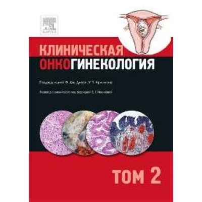 Клиническая онкогинекология. Том 2. Перевод с англ. под ред Новиковой Е.Г.